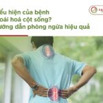 Biểu hiện của bệnh thoái hoá cột sống là gì? Hướng dẫn phòng ngừa hiệu quả