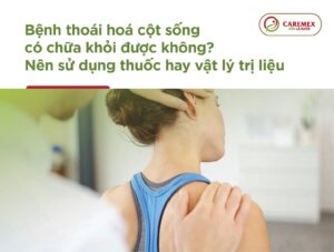 benh-thoai-hoa-cot-song-co-chua-duoc-khong-Caremex